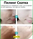 Фото превью товара - #2